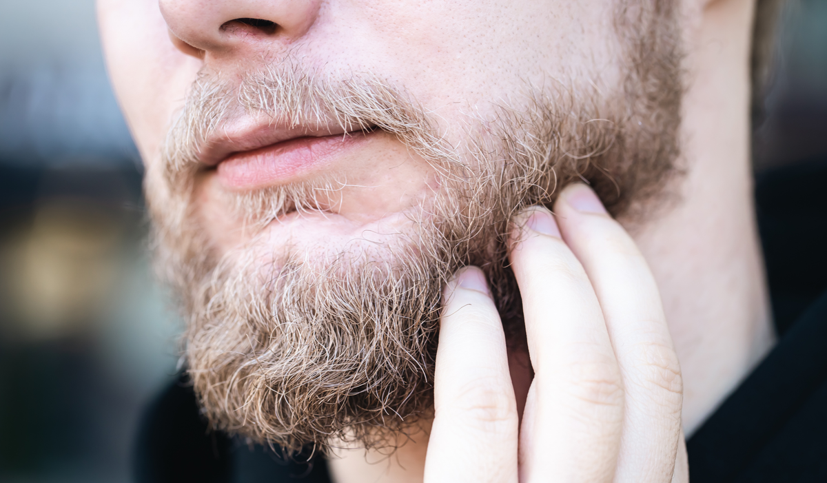 Itchy Beard? Here’s How to Finally Get Relief (and a Healthier Beard)