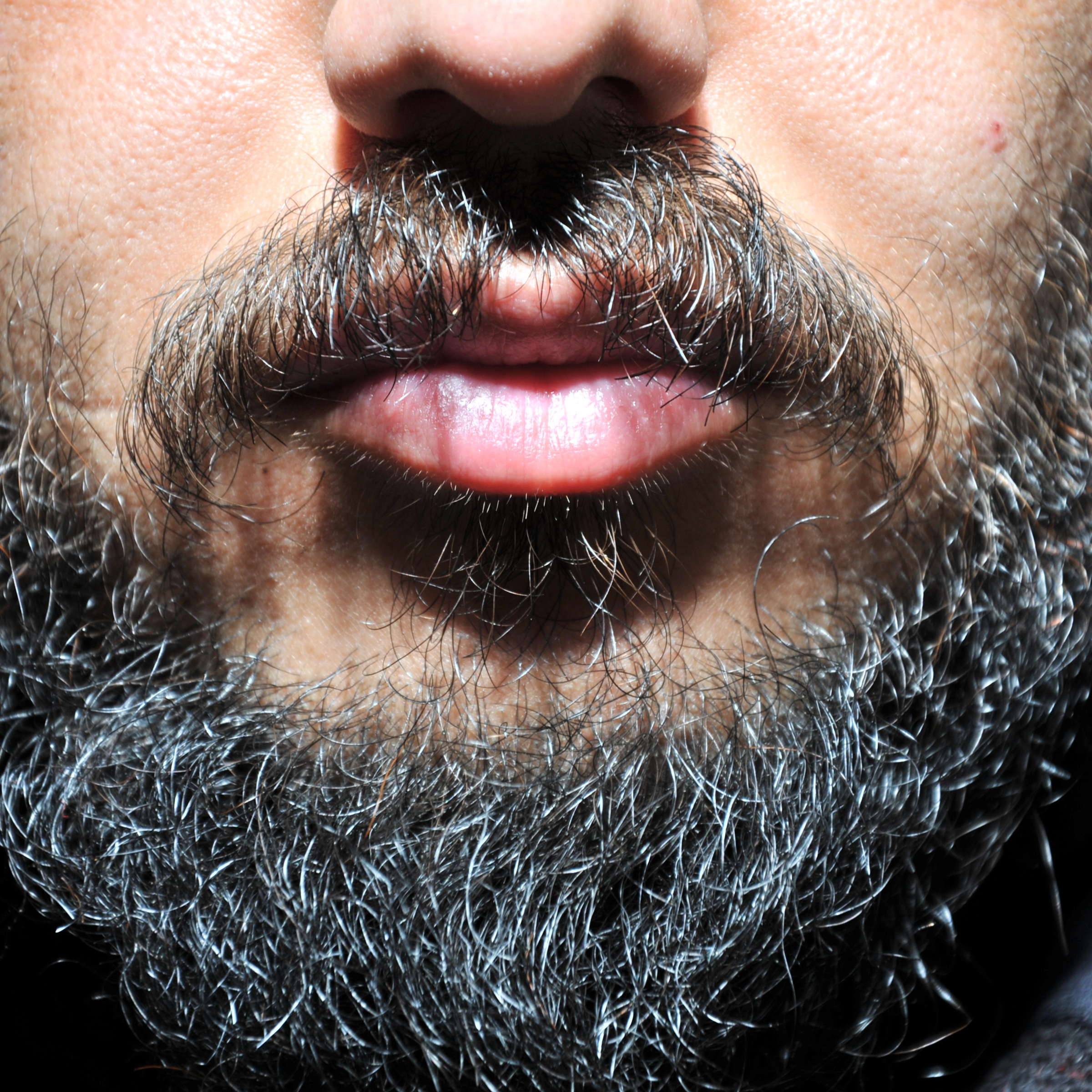 Dry, Brittle Beards