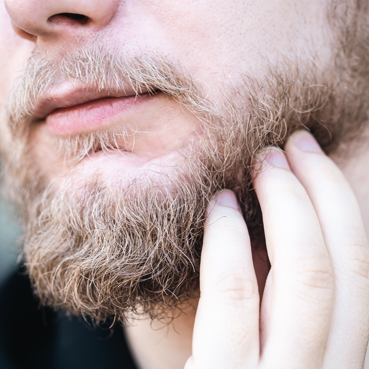 Itchy Beard Relief